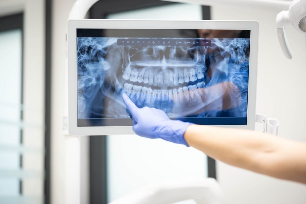 dental x-ray at At Meadowleaf Dental